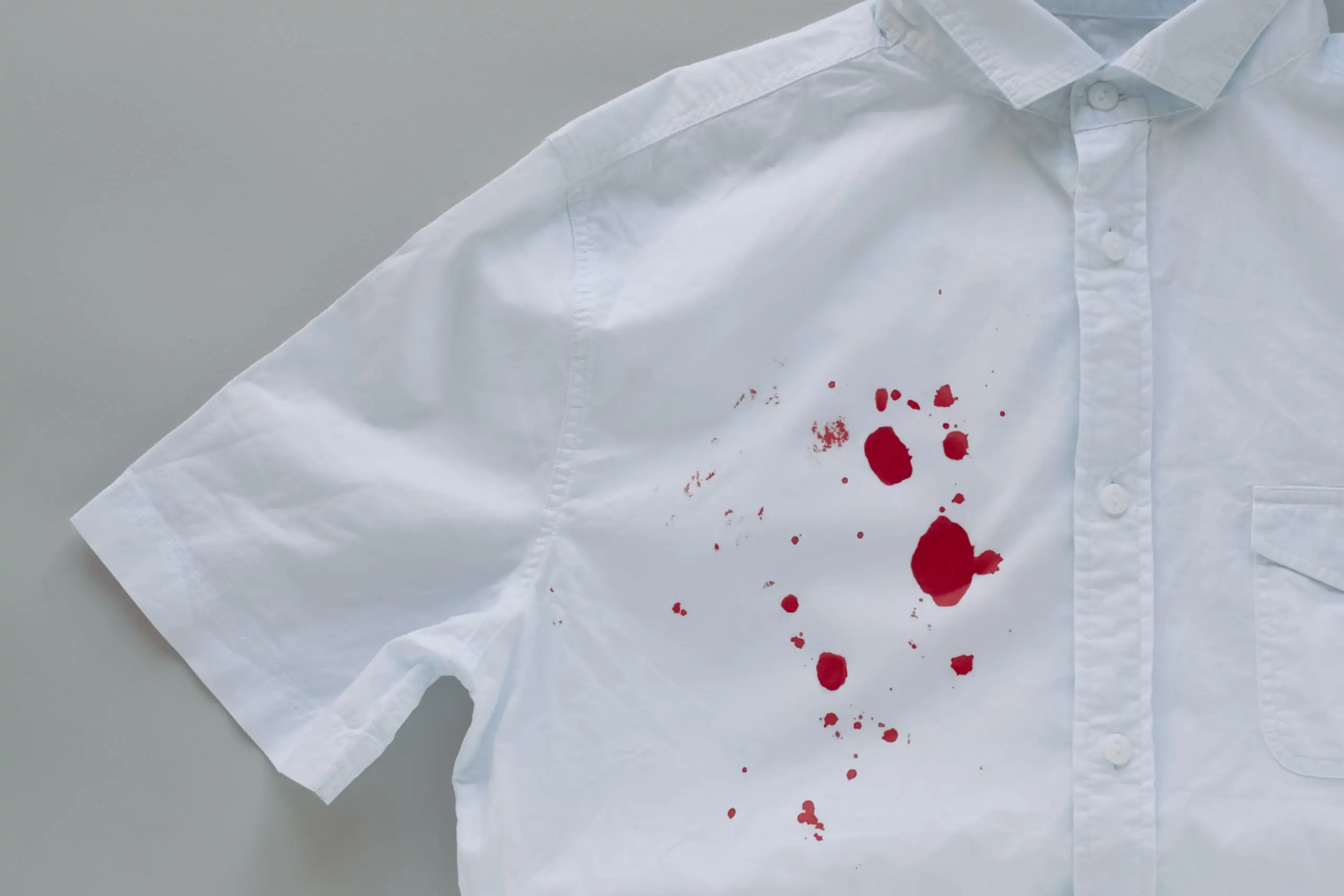 Blood,Stains,On,A,White,Shirt