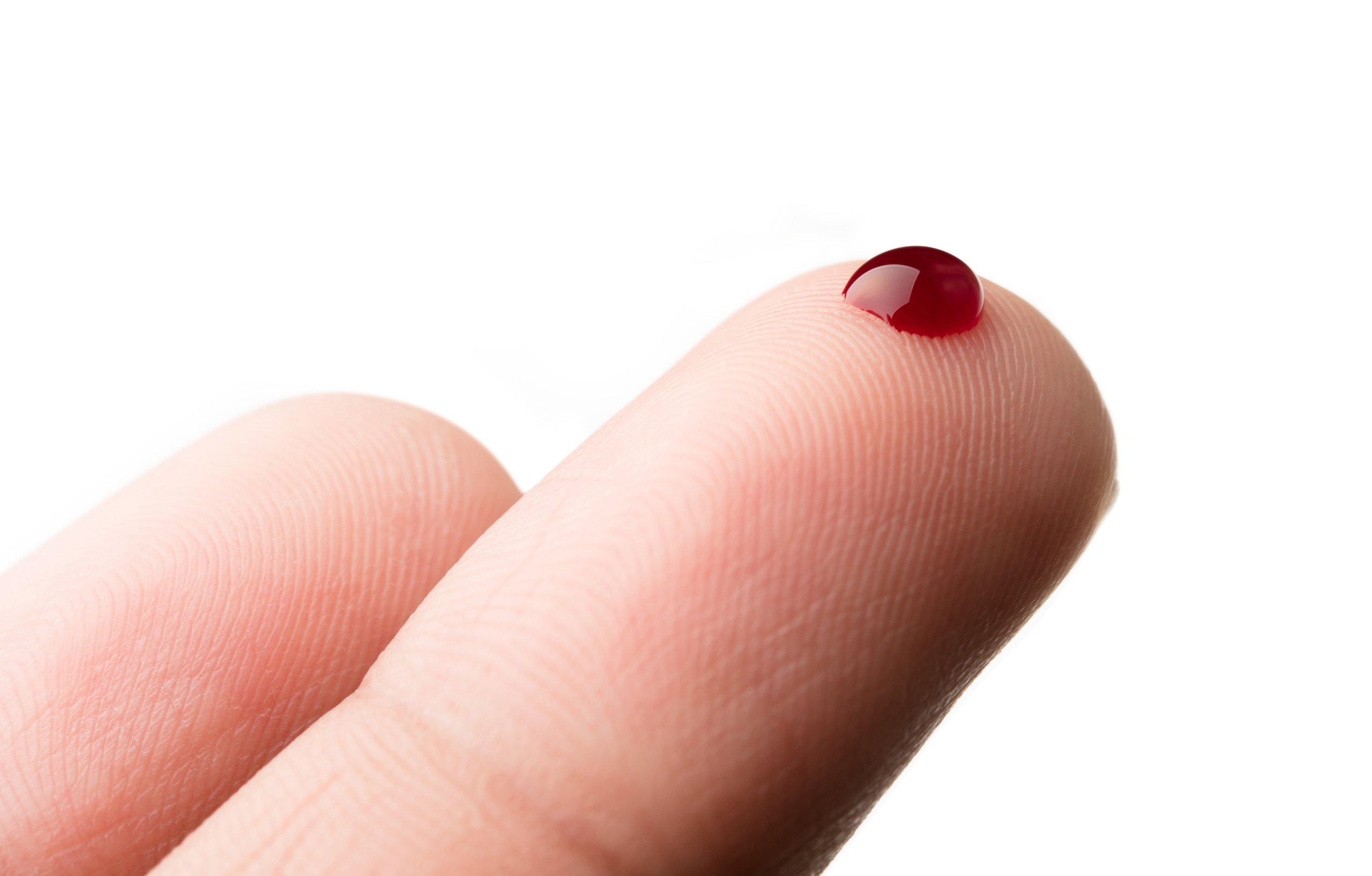 Is Blood or Pus from a Large Pimple Naajis and Does It Break Wudu? -